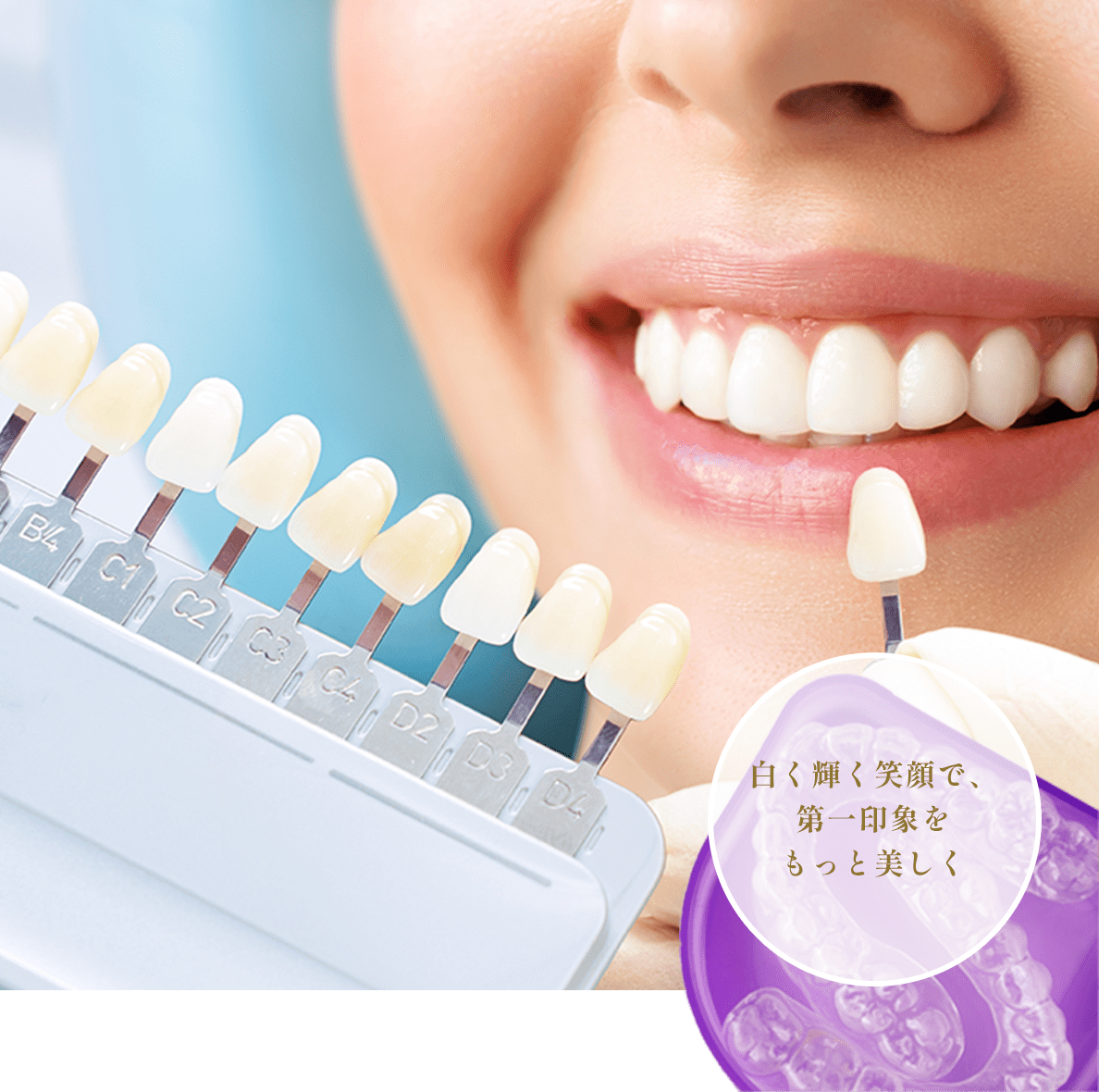 先進機器でのスキャンで歯を削る量を削減