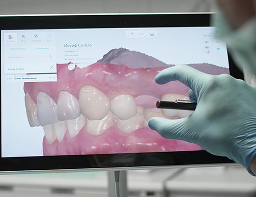 タブレットで歯科の画像を見ている様子